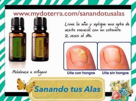 el aceite de coco sirve para los hongos delos pies