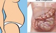 pubis hinchado