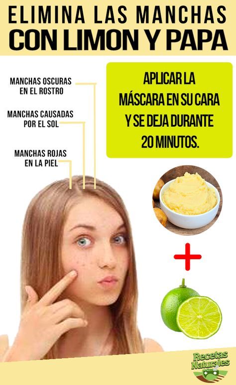 Cremas para las manchas dela cara por el sol