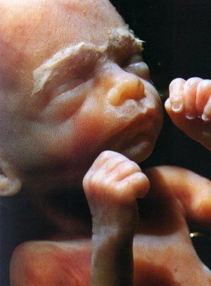 9 In The Womb Ideas Womb Human Embryo Pro Life