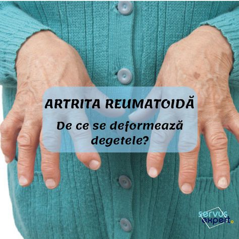 Suc cartof reumatism
