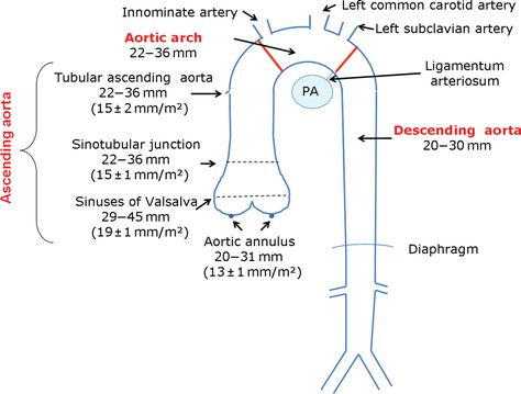 thoracic aorta googleda ara cardiovascular imaging pinterest aorta size chart