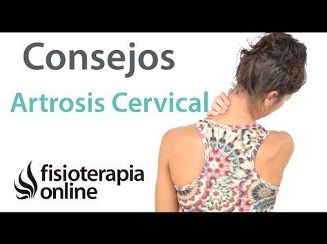 síntomas artrosis cervical