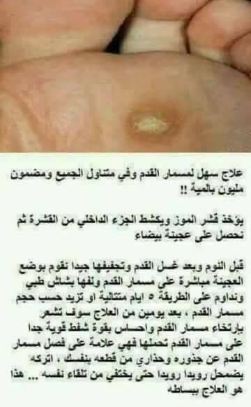Pin By Ummohamed On ورد وفل Health Fitness Nutrition Health And Fitness Expo Natural Medicine