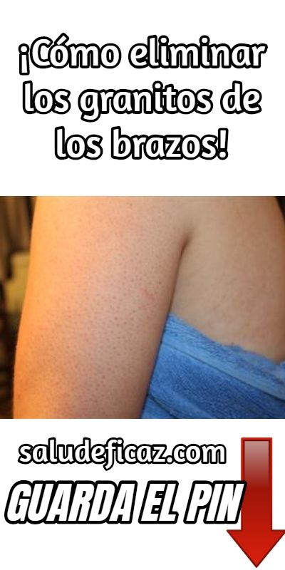Remedios caseros para eliminar granitos en las piernas
