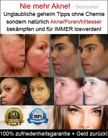 Eine Echte Sensation Grosse Poren Einfach Ganz Einfach Loswerden Mit Diesem Trick Haut Tipps Mitesser Poren