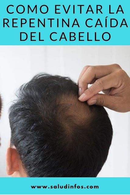 Cómo Prevenir Y Evitar La Caída Del Cabello El Cómo De Las Cosas Caída Del Cabello Remedios Para La Caída Del Cabello Crecimiento Del Cabello