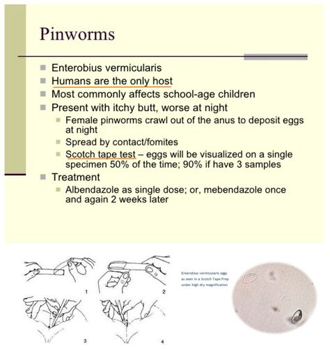 éles pinworms