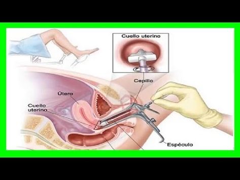 adenomio de próstata curativo