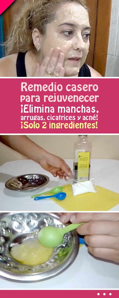 Pin On Belleza