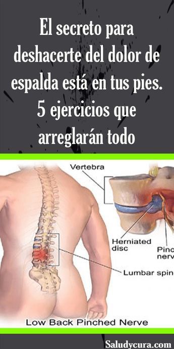 25 Ideas De Nervio Siatico En 2021 Nervio Dolor De Ciatica Dolor De Los Nervios