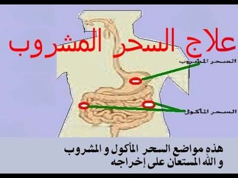 علاج السحر المشروب ابطال السحر بالقران Duaa Islam Learn Arabic Language Islam