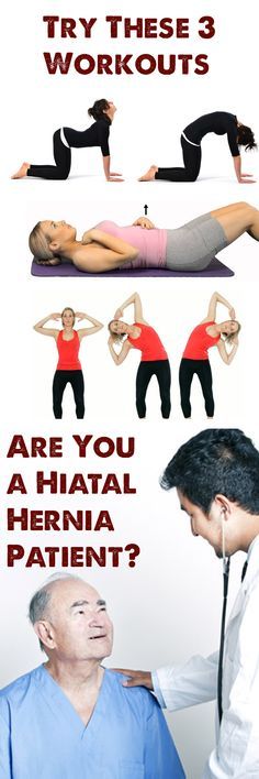 10 Ideas De Hernia Hiatal Tratamiento Hernia Hernia De Hiato Hiato