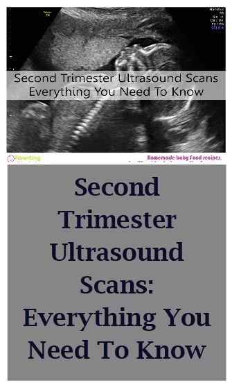 first trimester ultrasound scans everything you need to know first trimester ultrasound scans everything you need to know pregnancy and ultrasound