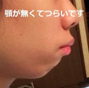 チコちゃんに叱られる その訳を知らない人のなんと多いことでしょう 見た目だけじゃない歯並びの大切さ 歯並び 健康になる 顔 チコちゃんに叱られる その訳を知らない人のなんと多いことでしょう 見た目だけじゃない歯並びの大切さ 歯並び 健康になる 顔
