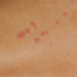 Pin On Pest Prevention Tips