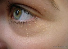 Pin On Belleza