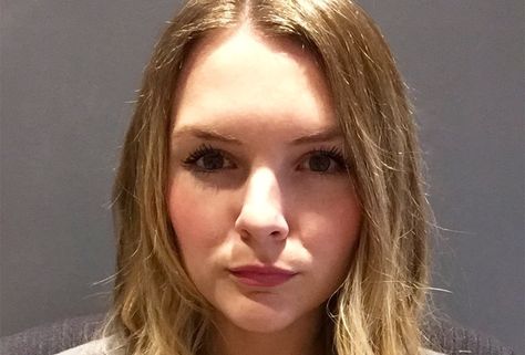 14 Youthful You ideas | botox, botox before and after, botox lips
