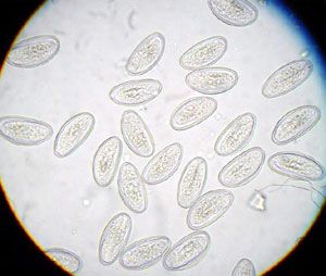 enterobius vermicularis graham