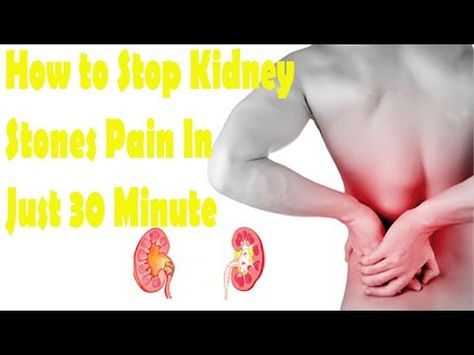 kidney stone pain area pictures kidney stone pain location pictures
