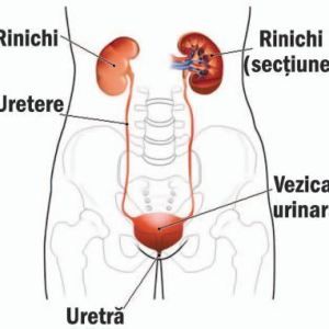 tratamentul vasului varicos