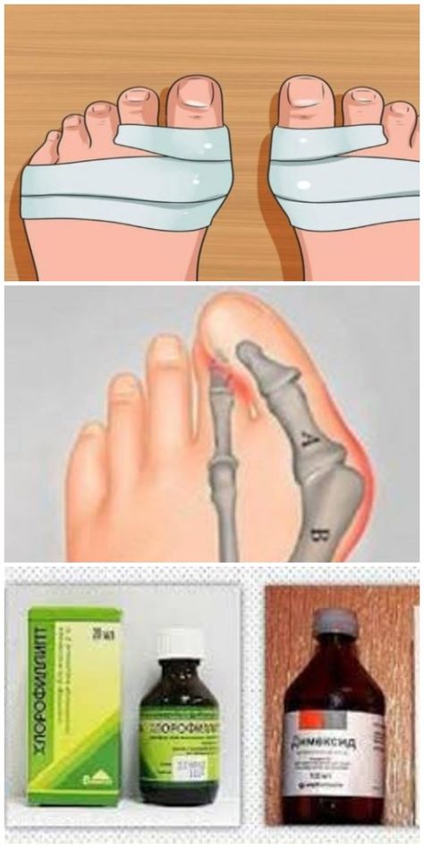Efectele secundare ale gonadotropinei corionice umane pierd în greutate. Reglarea menstruatiei