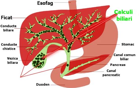 conductele biliare înfundate cu tratament cu paraziți)