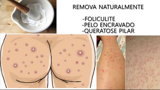 Sexo oral nela. Sexo chupando buceta na massagem