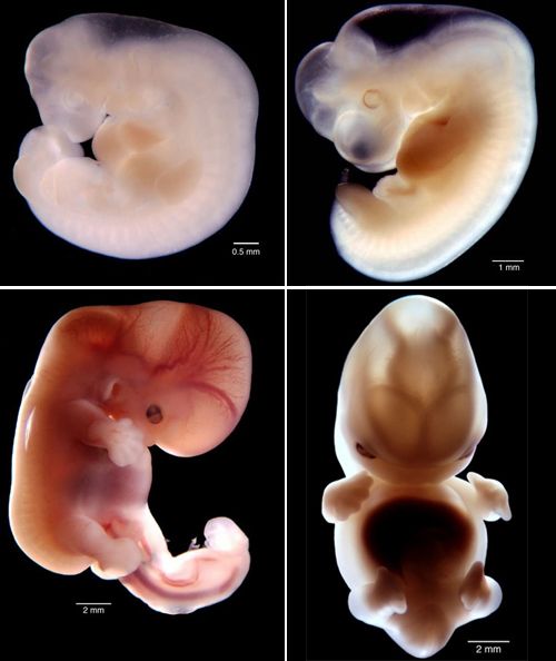 como se ve un bebe de 4 semanas en el vientre