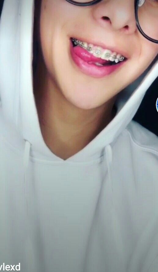 imagenes de brackets bonitos imagenes de brackets bonitos