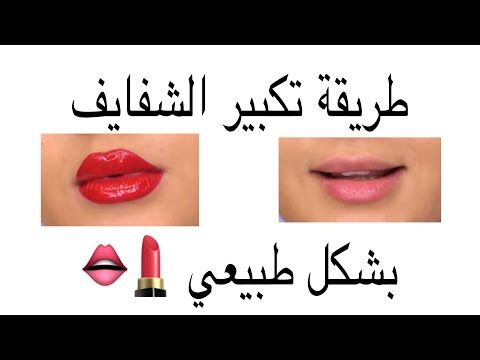 جلسة ميزو لتفتيح وتوريد الشفاه تم التصوير على احدى موظفات المركز مركز بيرل اسنان جلدية ليزر الرياض Dental Lipstick Beauty