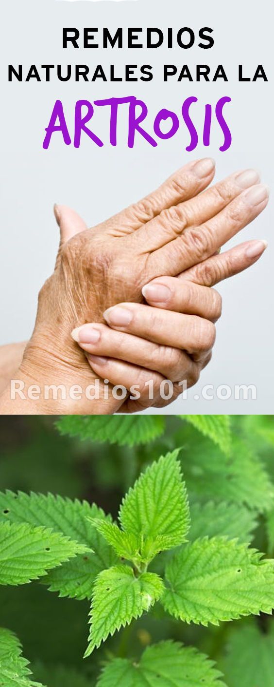Remedios naturales para curar la artritis en las manos