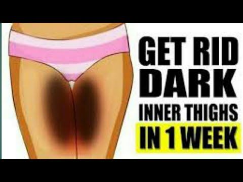 How to lighten your private area in a week // Bikini area, vagina, inner thighs whitening remedy..