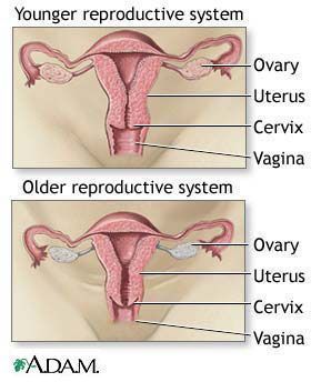 Medical Menopause Can Be Temporary or Permanent