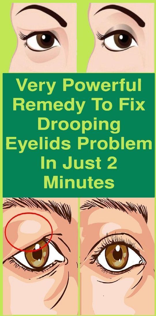 Very Powerful Remedy To Fix Drooping Eyelids Problem In Just 2 Minutes Usefullifehacks Drooping Eyelids Remedies Turmeric Benefits Very Powerful Remedy To Fix Drooping Eyelids Problem In Just 2 Minutes Usefullifehacks Drooping Eyelids Remedies Turmeric Benefits