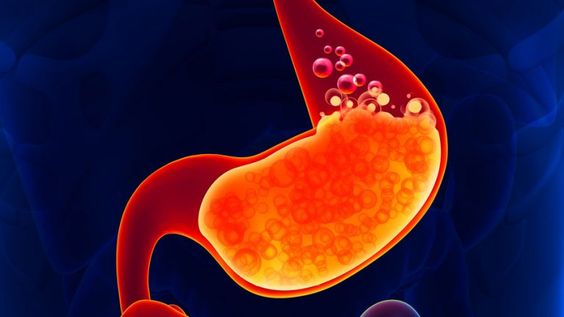 Magnifying Acid Reflux Magnifying Acid Reflux