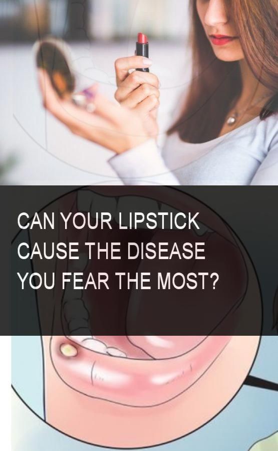 Can Your Lipstick Cause The Disease You Fear The Most Fear