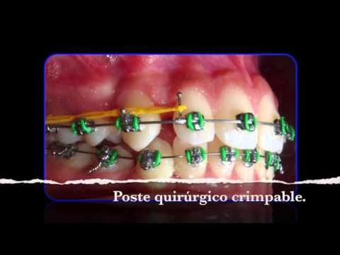 Pin En Odontologo