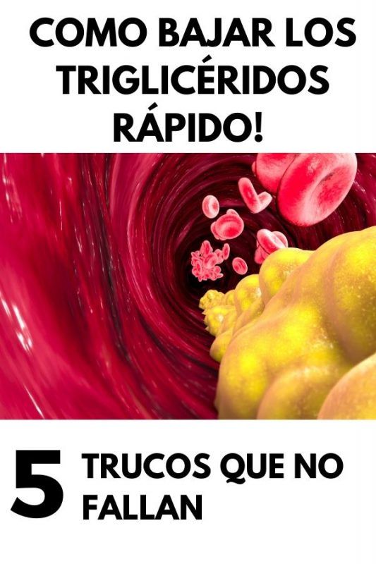 rutina de ejercicios para bajar los trigliceridos