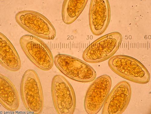 enterobius vermicularis artigo cura detoxifiere de o zi
