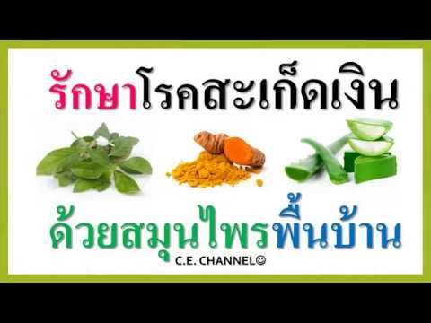 ร กษาโรคสะเก ดเง นด วยสม นไพรพ นบ าน