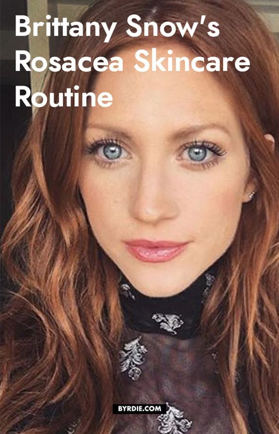 Brittany Snow Cleared Her Chronic Rosacea Using These 5 Products