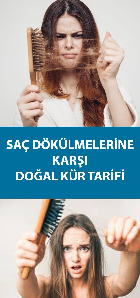 Sac Dokulmelerine Karsi Evde Kolayca Hazirlaya Bileceginiz Basit Malzemeler Ile Yapilmis Dogal Sac Dokulmesine Karsi Kur Tarifi Sac Dogal Dogal Sac Sac Dokulmelerine Karsi Evde Kolayca Hazirlaya Bileceginiz Basit Malzemeler Ile Yapilmis Dogal Sac Dokulmesine Karsi Kur Tarifi Sac Dogal Dogal Sac