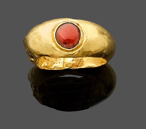 deformation bague or deformation bague or