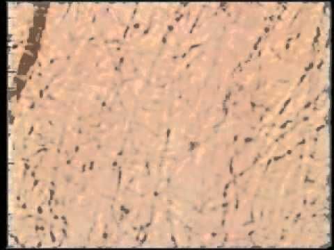 شفاءات الحجامة الجزء الثالث Polaroid Film Film Camera