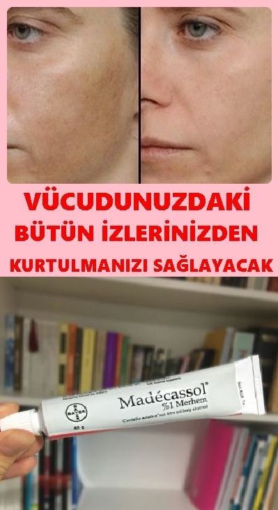 Madecassol Ne Kremi Sorusuna Cevap Olarak Icerisindeki Centella Asiatica Bitkisinden Alinan Ham Maddesiyle Cildi Onarip Yenil Facial Yoga Skin Maskcara Beauty Madecassol Ne Kremi Sorusuna Cevap Olarak Icerisindeki Centella Asiatica Bitkisinden Alinan Ham Maddesiyle Cildi Onarip Yenil Facial Yoga Skin Maskcara Beauty