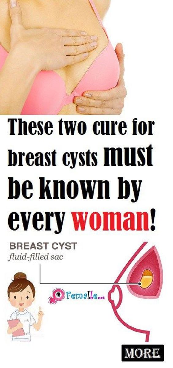 THESE TWO CURE FOR BREAST CYSTS MUST BE KNOWN BY EVERY WOMAN!