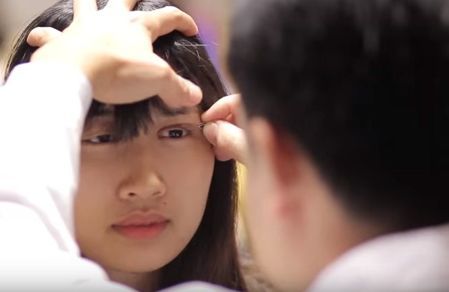 Bác sỹ tư vấn trước khi thực hiện cắt mí mắt