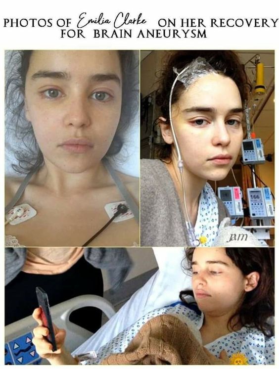 Emilia Clarke Recovery