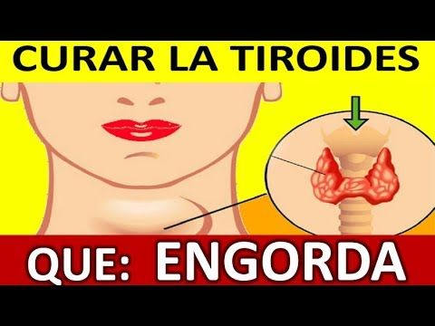 Como es vivir sin tiroides